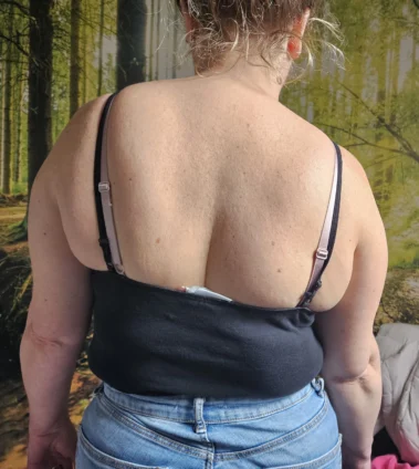 Hier is te zien hoe scheef de persoon staat vóór de behandeling