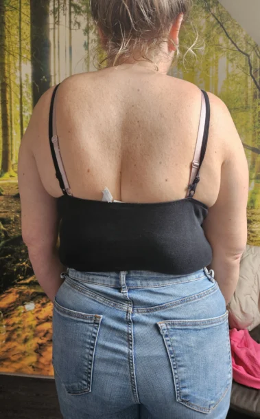 Hier is te zien hoe recht de persoon weer staat na de behandeling